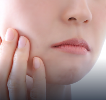 しみ・そばかす