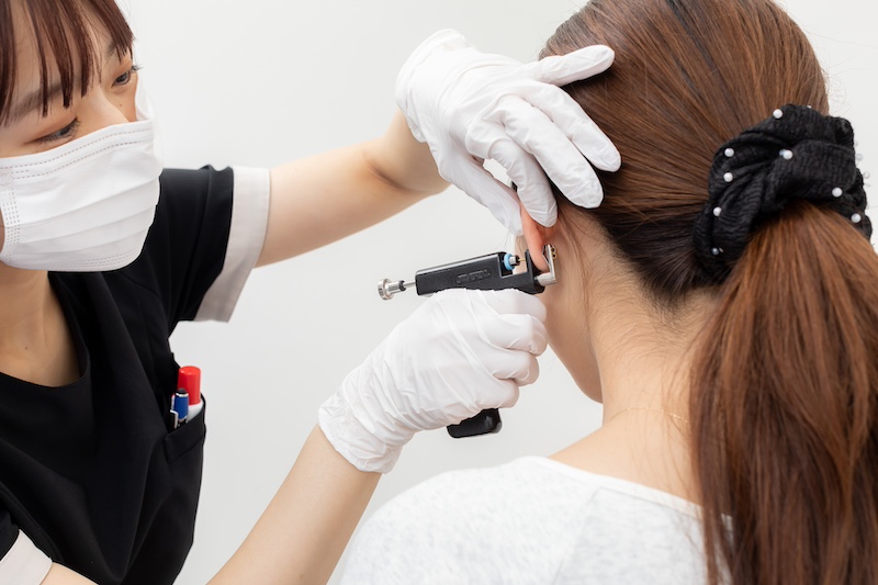 ピアスの穴あけ