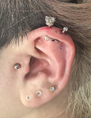 アンテナヘリックス（王冠）