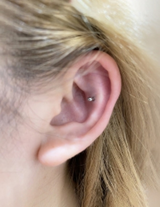 インナーコンク