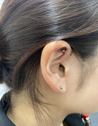 フォワードヘリックス