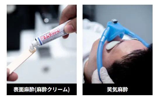 ゴリラクリニックの麻酔